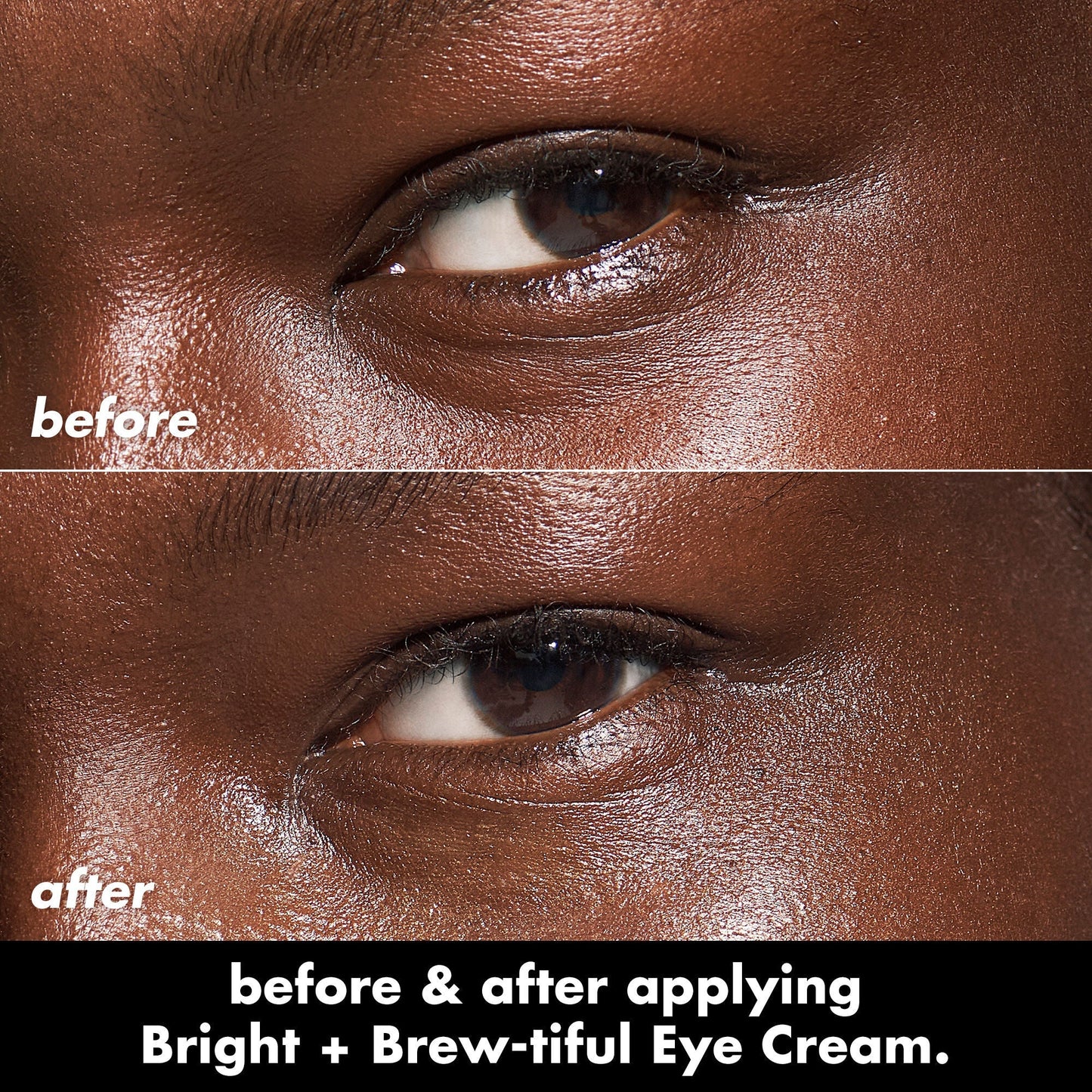 bright-brew-tiful-eye-cream-l0 0226_BBEC_Eye_BA_Diptych_607e3ec2-f0e1-4365-9b28-17574d841250.jpg