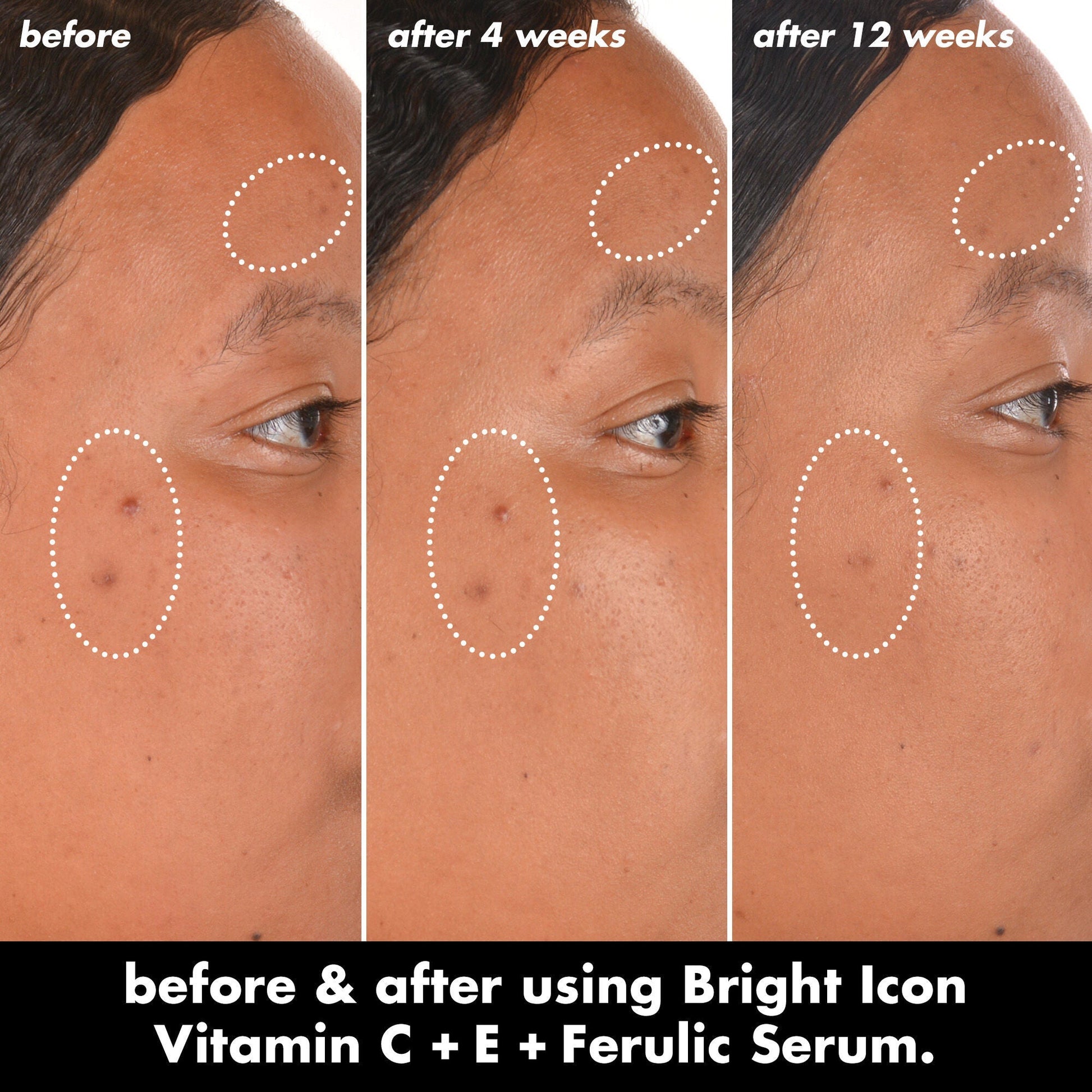 bright-icon-vitamin-c-e-ferulic-serum-r1 0226_EDU_BrightIconVitC_BA_Chanel_TRIPTYCH_c58f2fc8-209d-414f-9ba3-666a07a94887.jpg