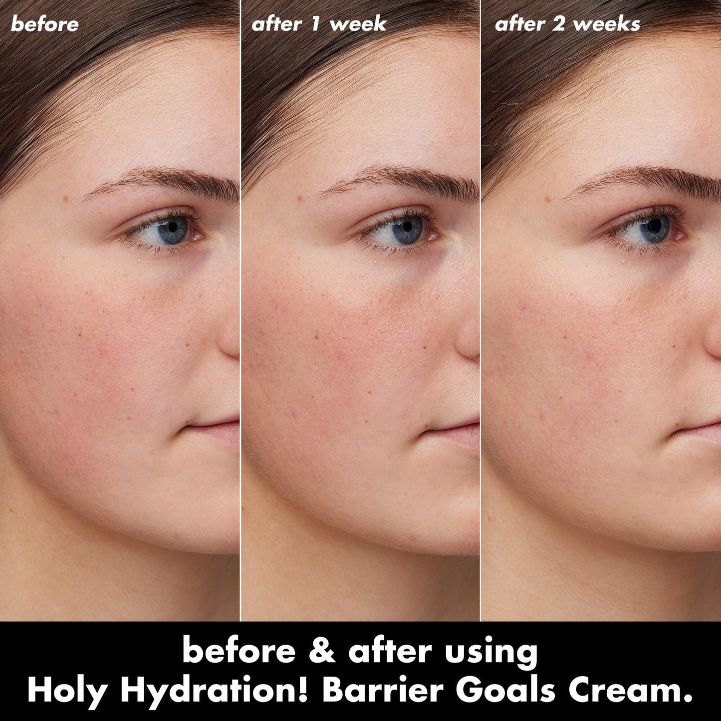 holy-hydration-barrier-goals-cream-mini-a0 0226_EDU_HHBarrierGoalsCream_B_A_Zoe_TRYPTICH_4f0e5b5d-35fb-4020-968e-244d4536afbd.jpg