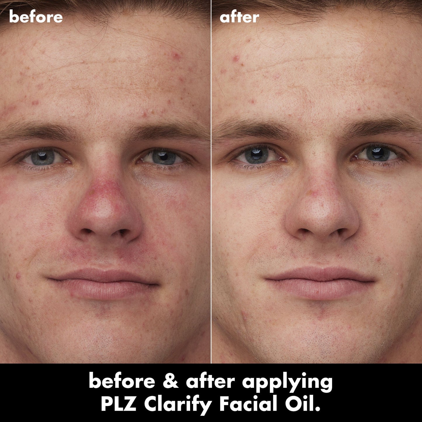plz-clarify-facial-oil-g8 0326_EDU_PlzClarify_BA_Caleb.jpg