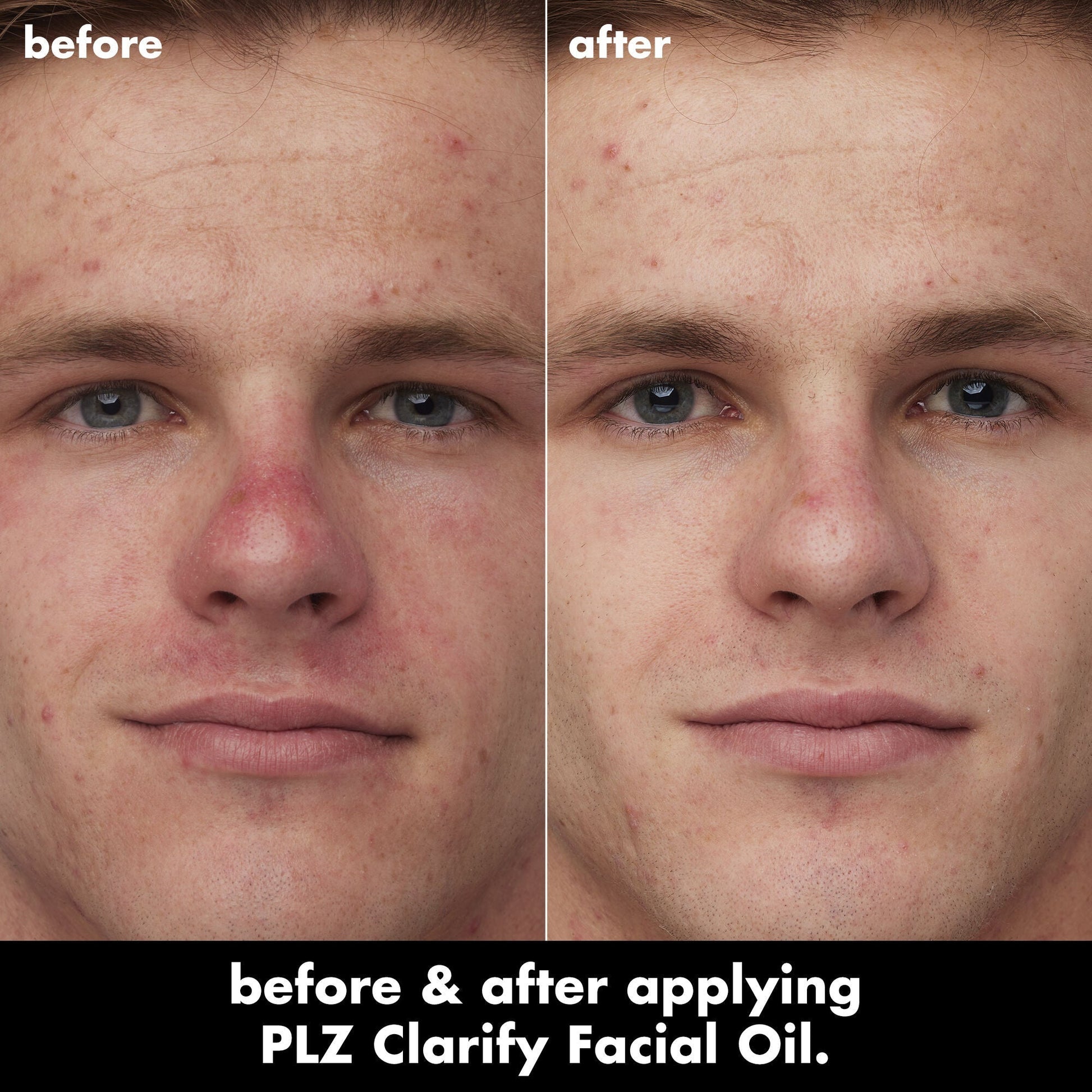plz-clarify-facial-oil-g8 0326_EDU_PlzClarify_BA_Caleb.jpg