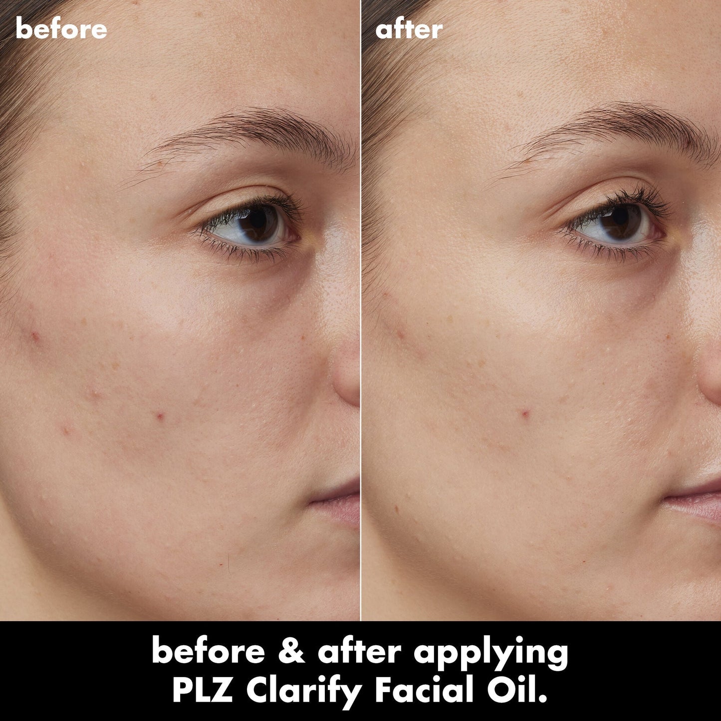 plz-clarify-facial-oil-g8 0326_EDU_PlzClarify_BA_Kelly.jpg