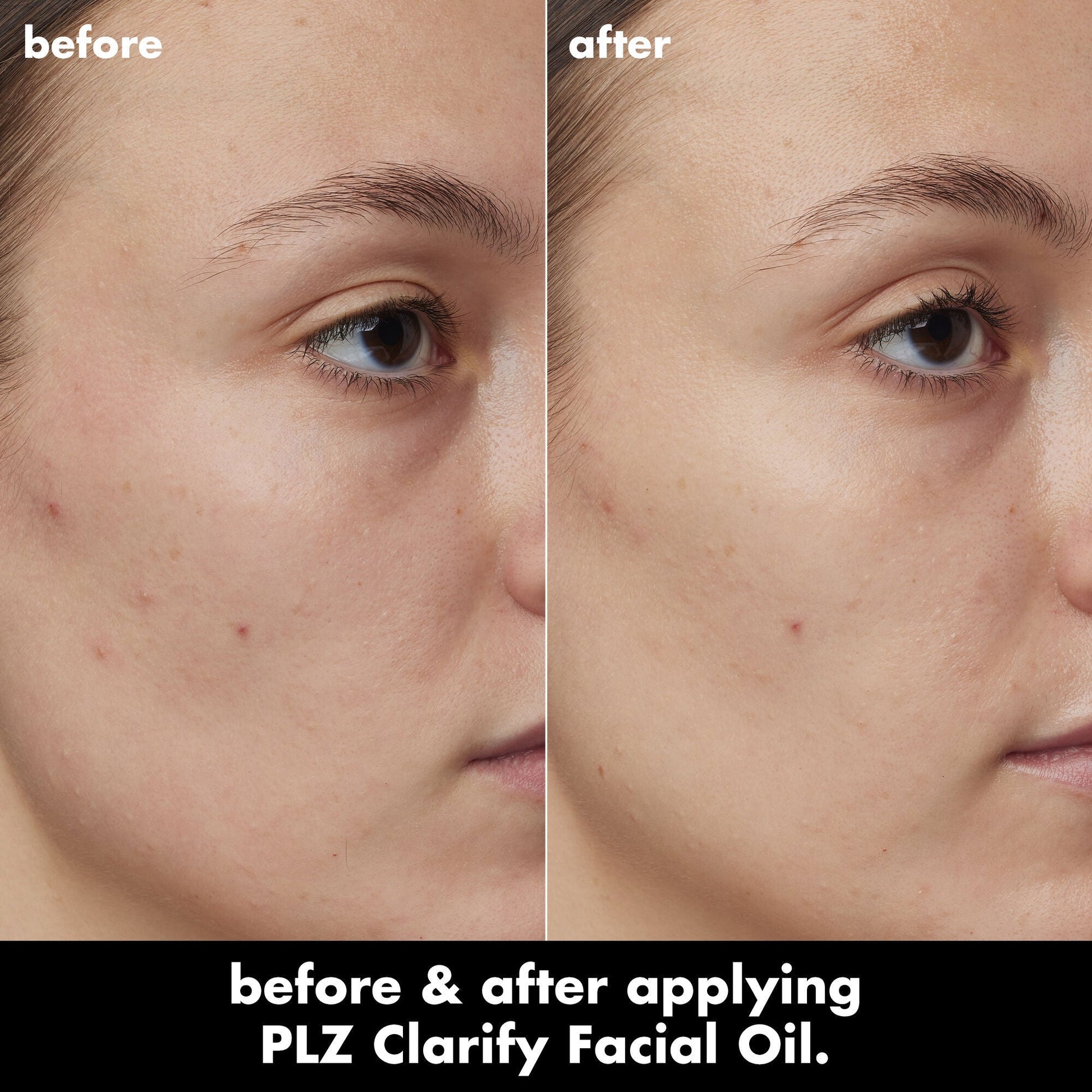 plz-clarify-facial-oil-g8 0326_EDU_PlzClarify_BA_Kelly.jpg