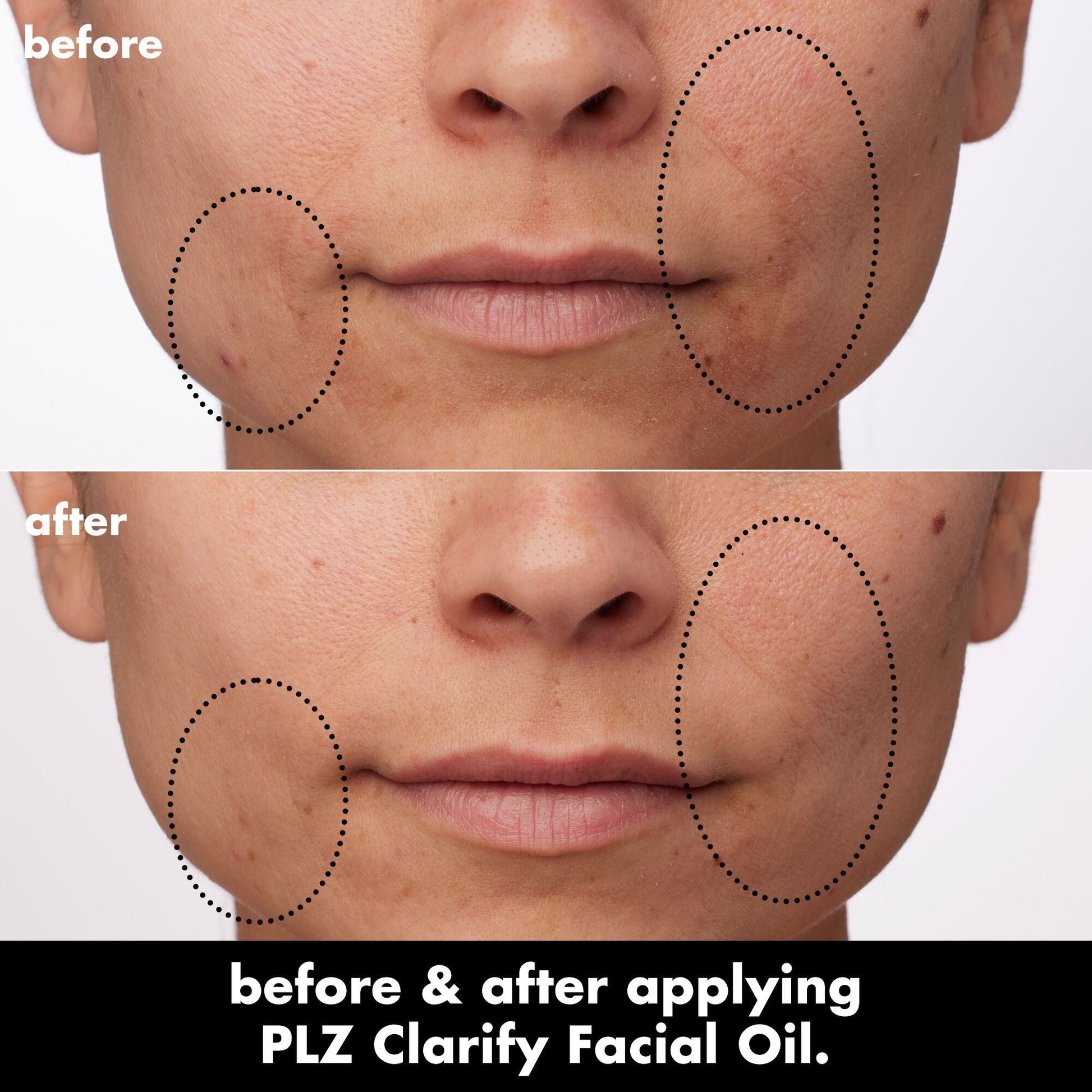 plz-clarify-facial-oil-g8 0326_EDU_PlzClarify_BA_Paula.jpg