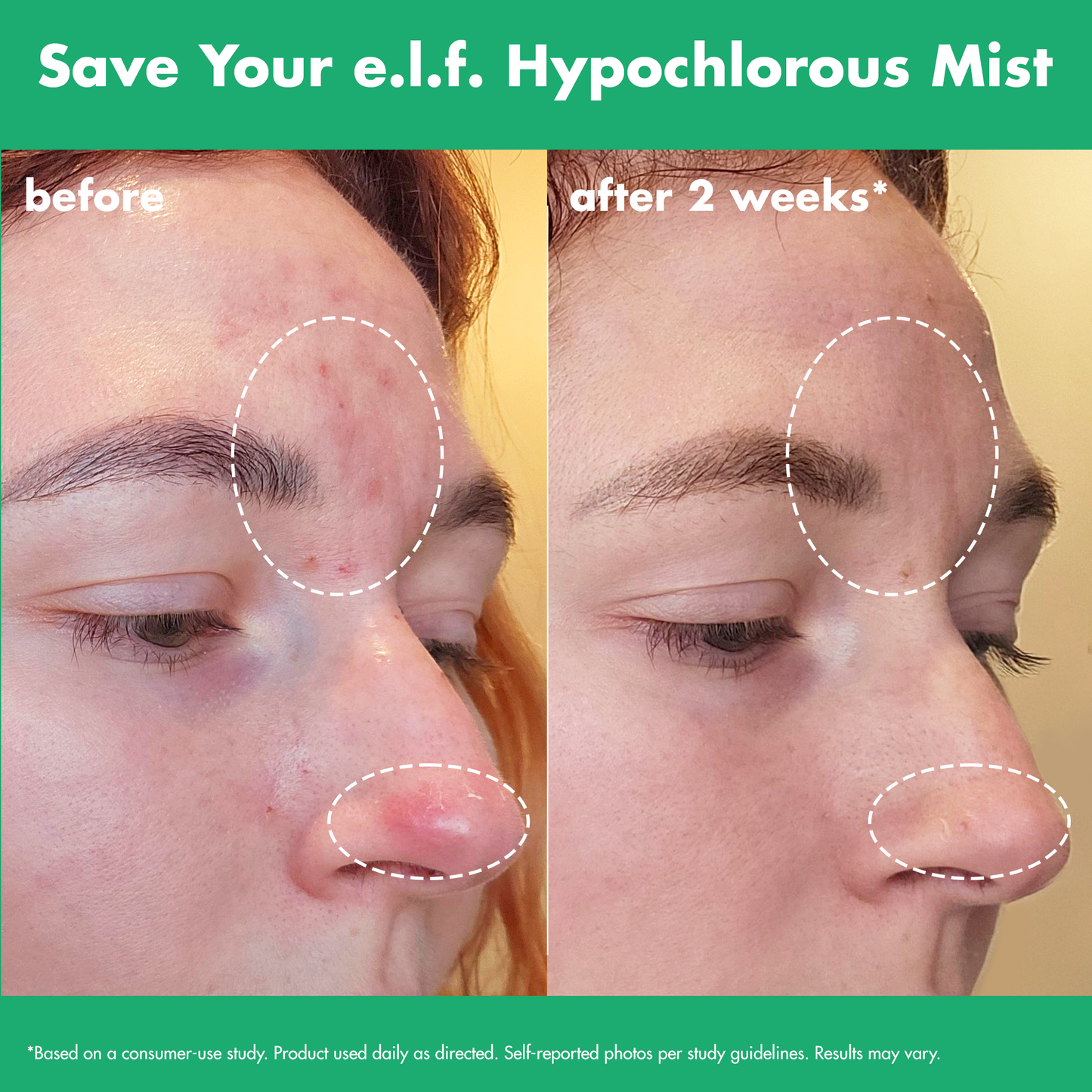 save-your-e-l-f-hypochlorous-mist-h5 FA26_EDUCATION_SAVEYOURELF_USAGE_BA1_WITHOUT_CLAIMS.png