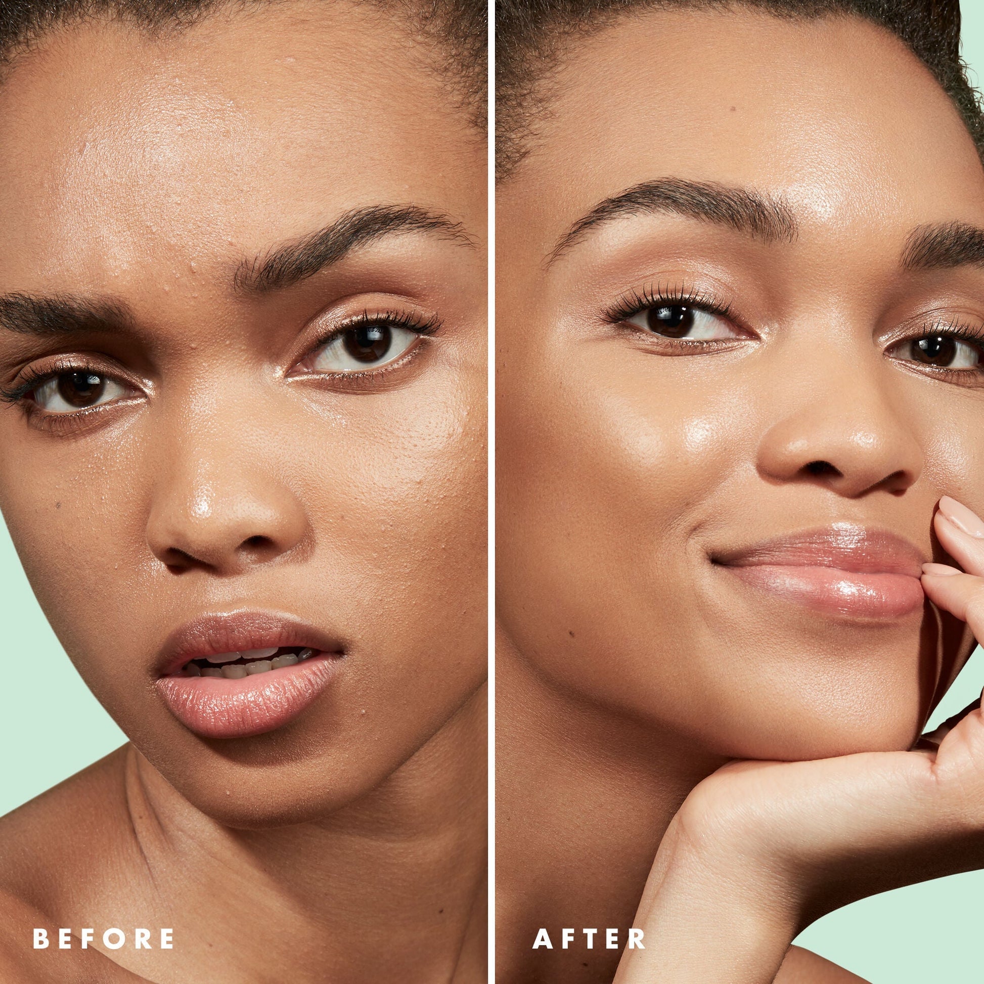 blemish-control-face-primer-large-size-g6 Primer_PP_Before_After_BlemishControl_2000x2000_3774231e-d4e1-49dd-b3d7-a73cbac901fe.jpg